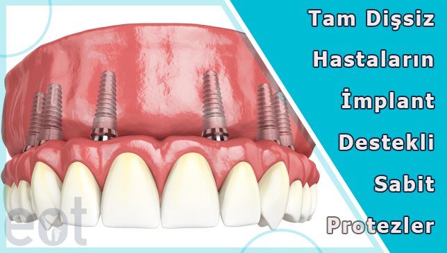 tam-dissiz-protez-implant