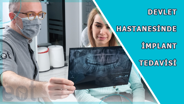 devlet-implant