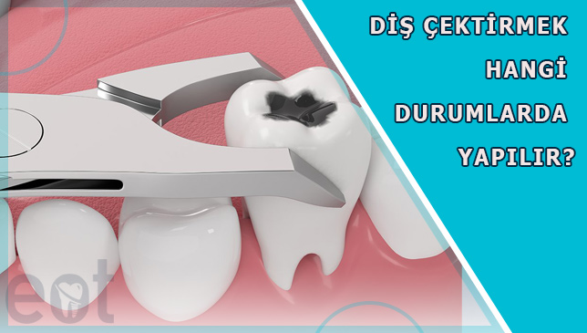 dis-cektirmek