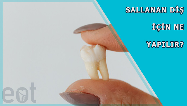 sallanan-dis