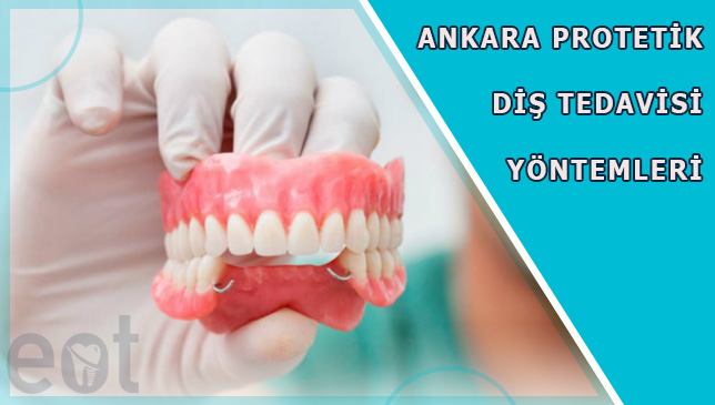Ankara-Protetik-Dis-Tedavisi
