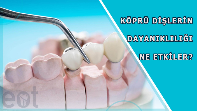 Kopru-Dislerin-Dayanikliligi-Ne-Etkiler