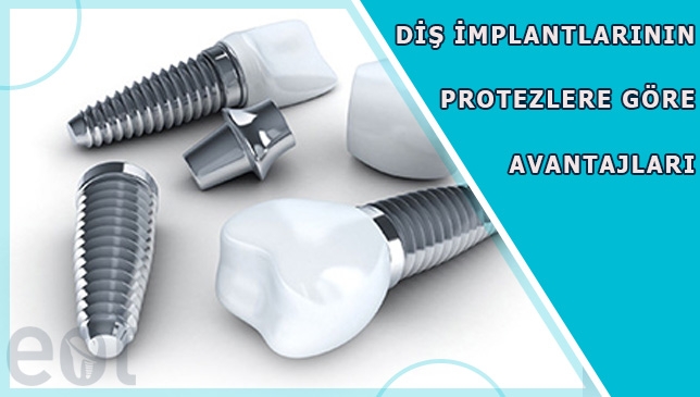 Dis-implantlarinin-Protezlere