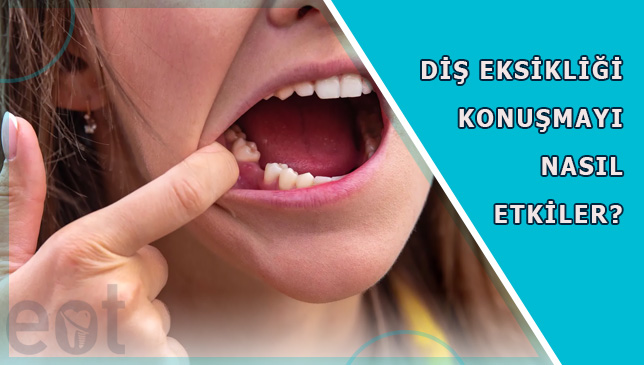 Dis-Eksikligi-Konusmayi