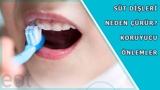 Sut-Disleri-Neden-curur