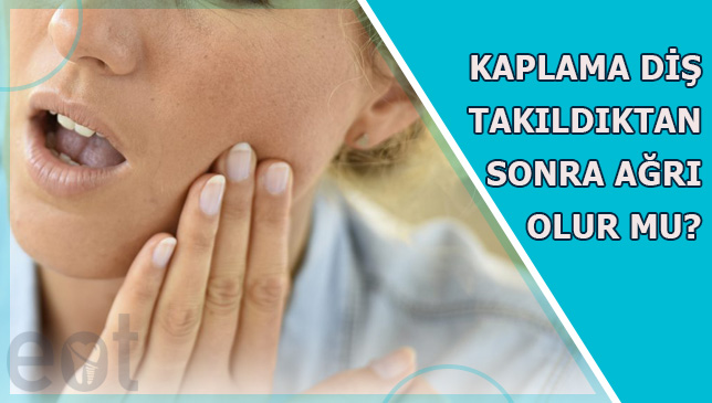 Kaplama-Dis-Takildiktan-Sonra