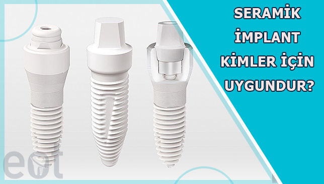 Seramik İmplant Ankara, Seramik İmplant Fiyatları