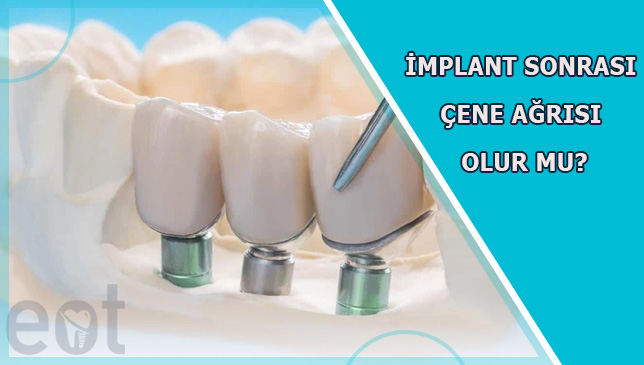 implant-sonrasi-cene-agrisi (1)