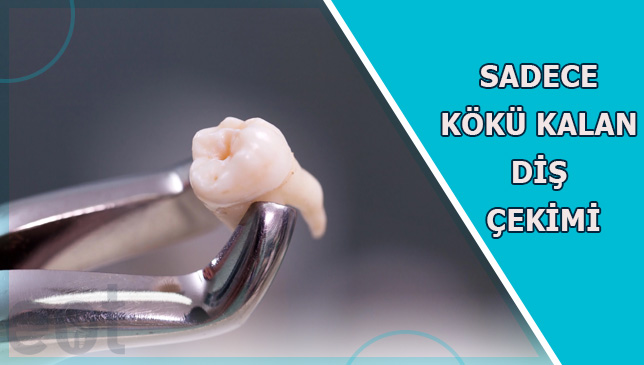Koku-Kalan-Dis-cekimi